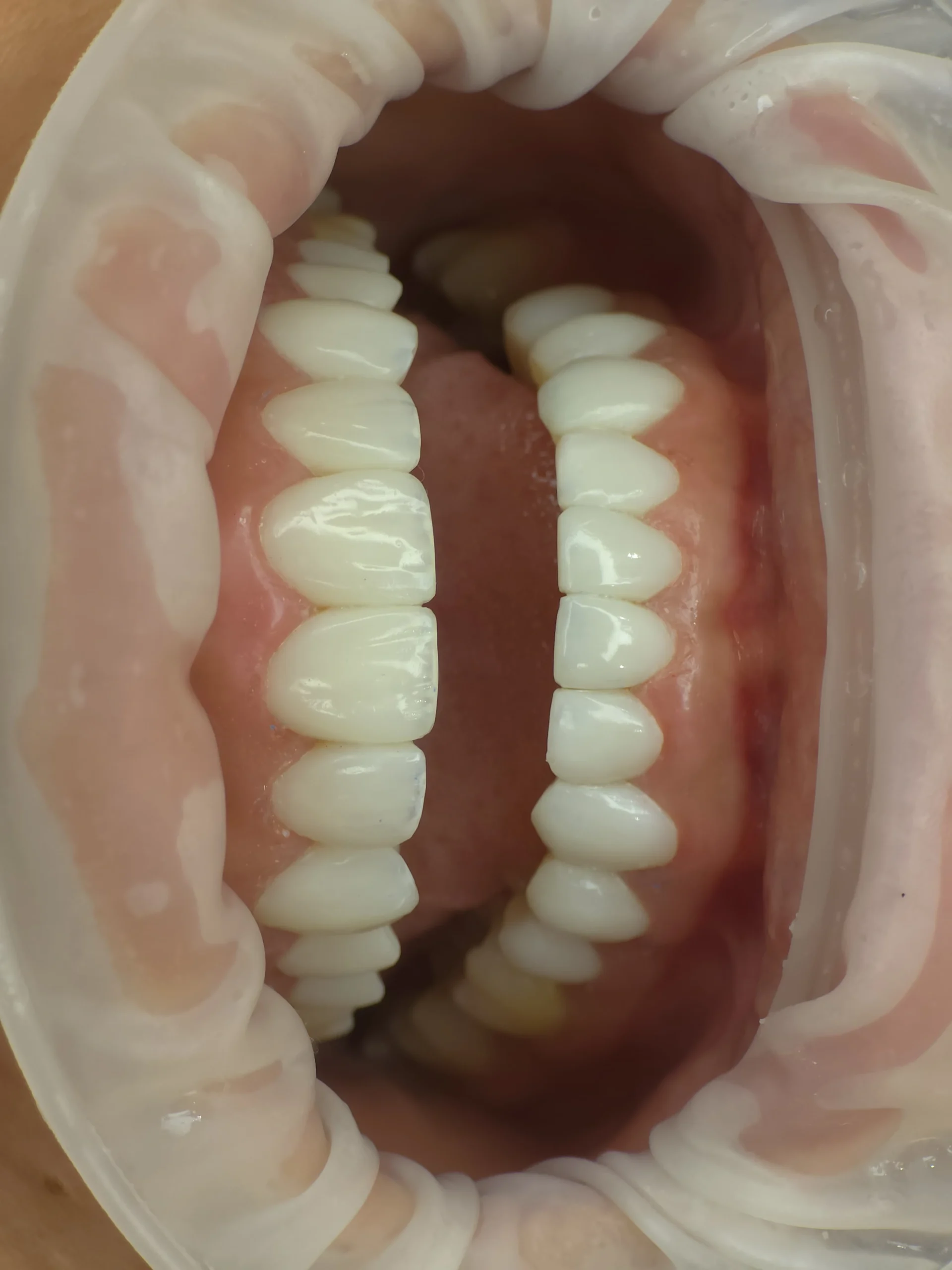 Altara-Beauty-Smile-carrusel-1